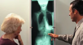 Doctor reviewing a spinal X-ray with a patient